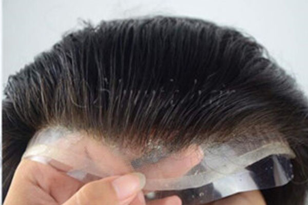 Hair Wig Dealer | Hair Replacement Studio in Hadapsar, Pune - New Look Hair Studio and Clinic